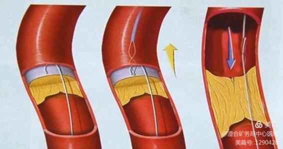 微信图片_20200922144108.jpg 微信图片_20200922144108.jpg