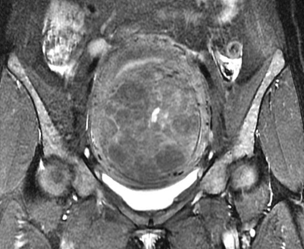 图片3.jpg 图片3.jpg