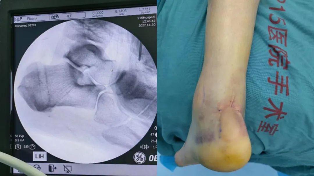 微信图片_20221214085129.jpg 微信图片_20221214085129.jpg