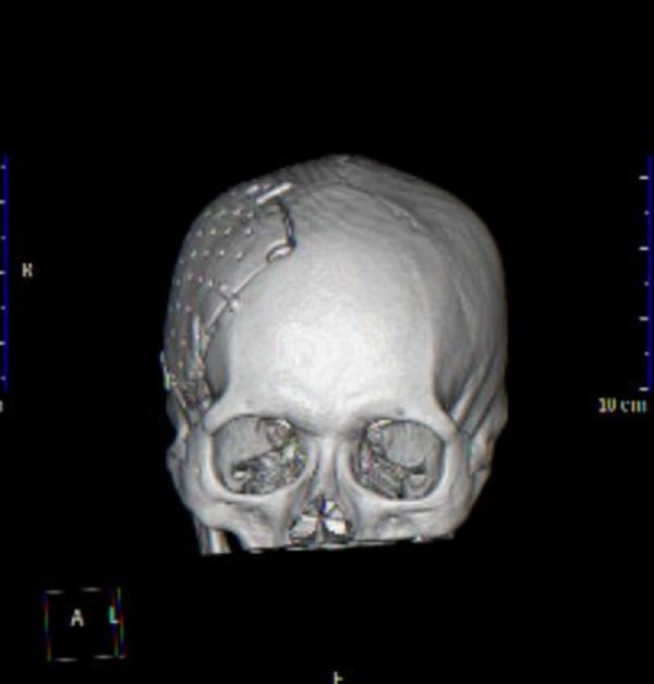 图片3.jpg 图片3.jpg