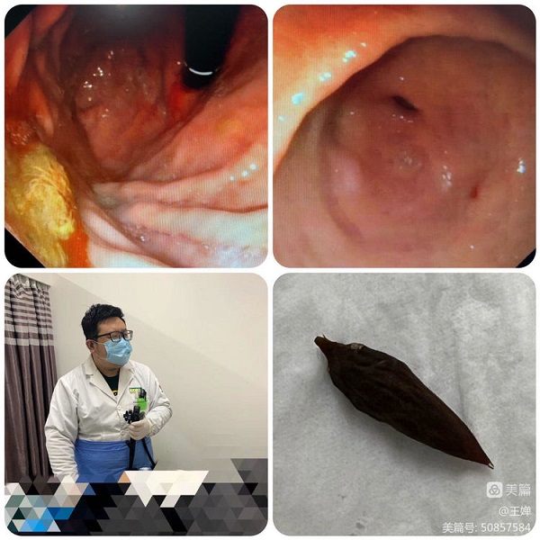 3c6b22b417c842b1b701da450cea3d37.jpeg 3c6b22b417c842b1b701da450cea3d37.jpeg