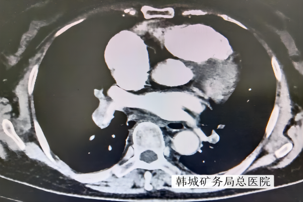 图片1(1).png 图片1(1).png